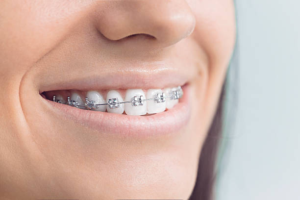 Trusted Lynn, IN Holistic Dental Care Services Experts